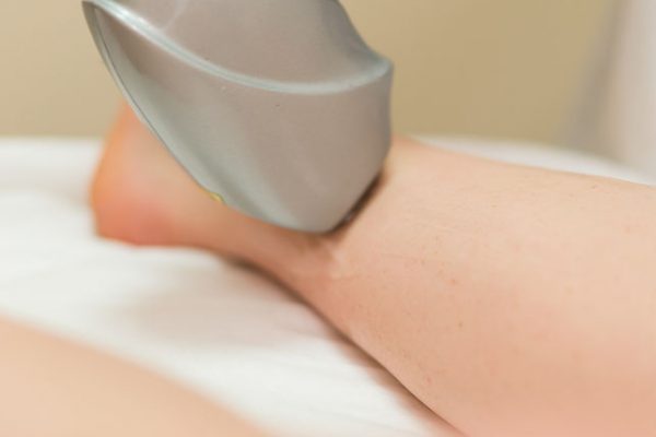 leg getting an ultrasound scan